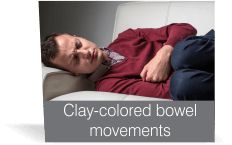 Clay-colored bowel movements